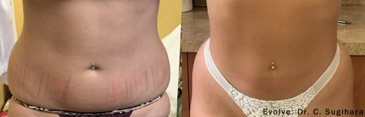 evolve-before-after-dr-c-sugihara-preview-1